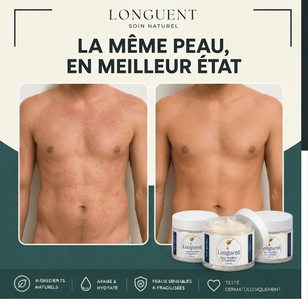 Longuent — Baume Réparateur Apaisant pour Peaux Sèches, Eczéma & Psoriasis